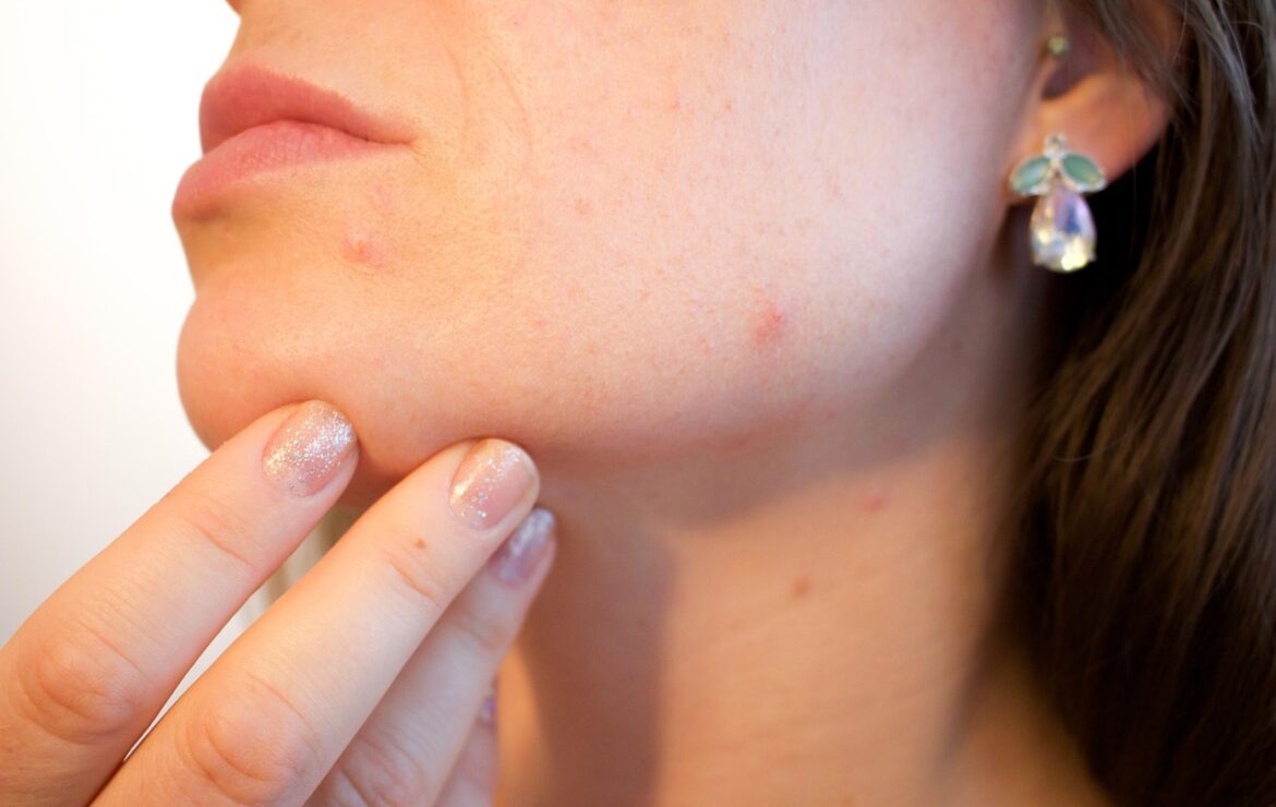 Bloedprikken op hormonen