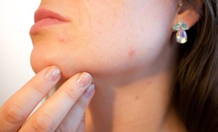 Bloedprikken op hormonen