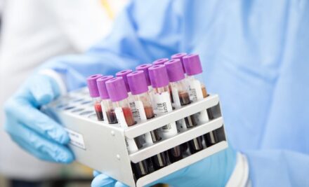 Testosteron Bloedtest